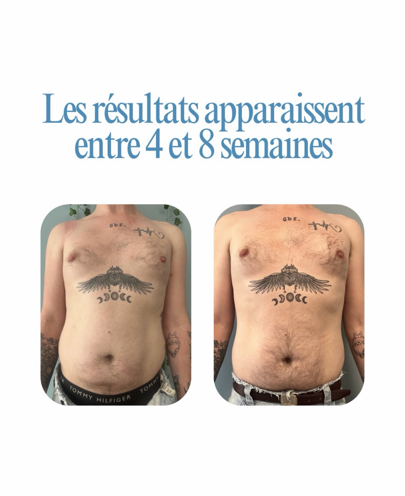 Foto 45 di DERMASHAPE